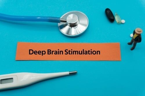 How Deep Brain Stimulation (DBS) Helps Cognitive Function After a TBI