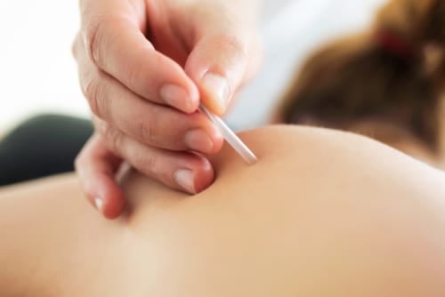 Trigger Point Injections vs. Epidural Steroid Injections